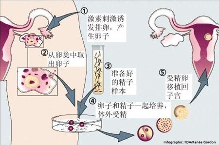 供卵试管选性别代生咨询